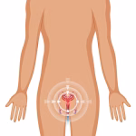 prostrate quiz