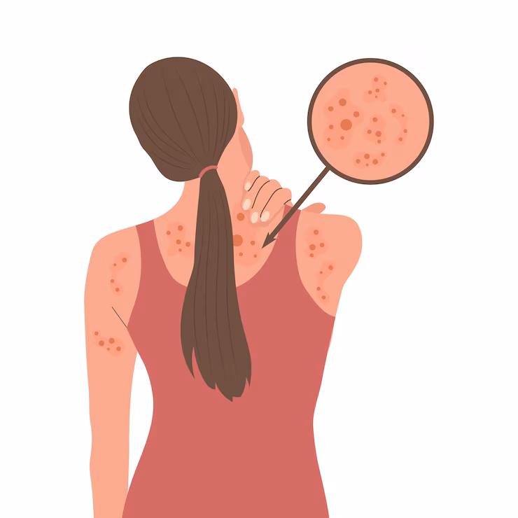 skin conditions